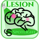 LesionSpotlight.png