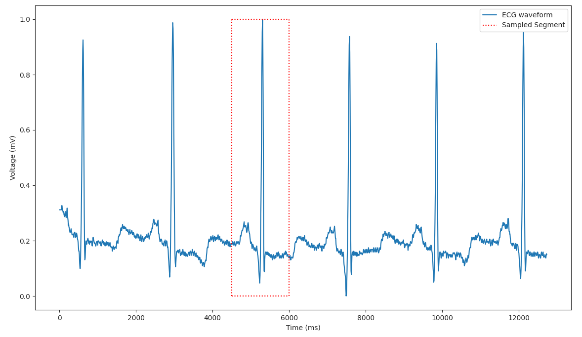 full_ecg_wave.png