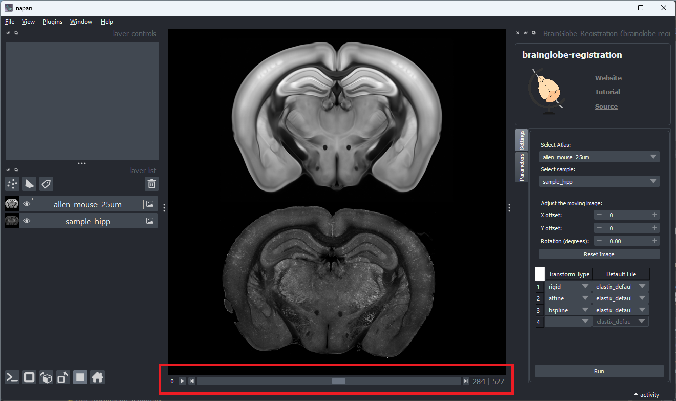 brainglobe_registration_atlas_selection_2.png