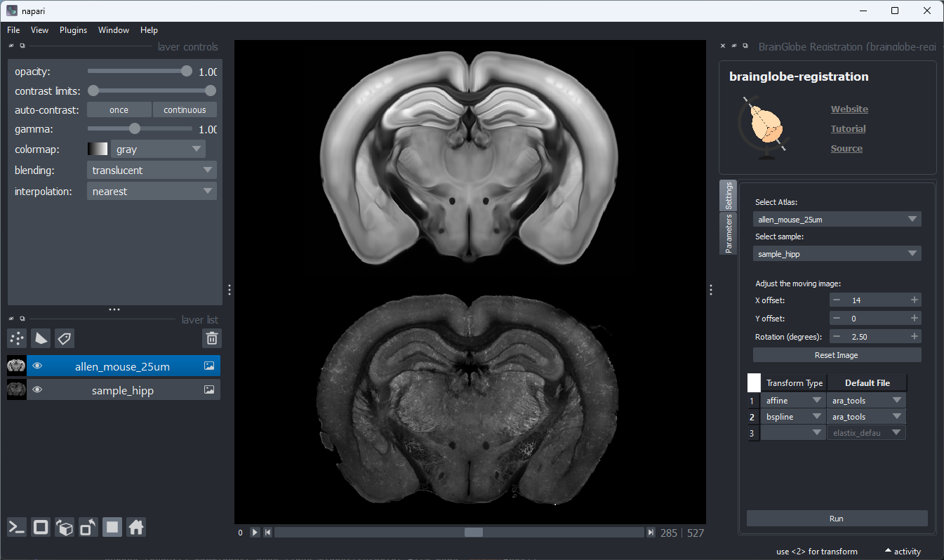 brainglobe_registration_main.png