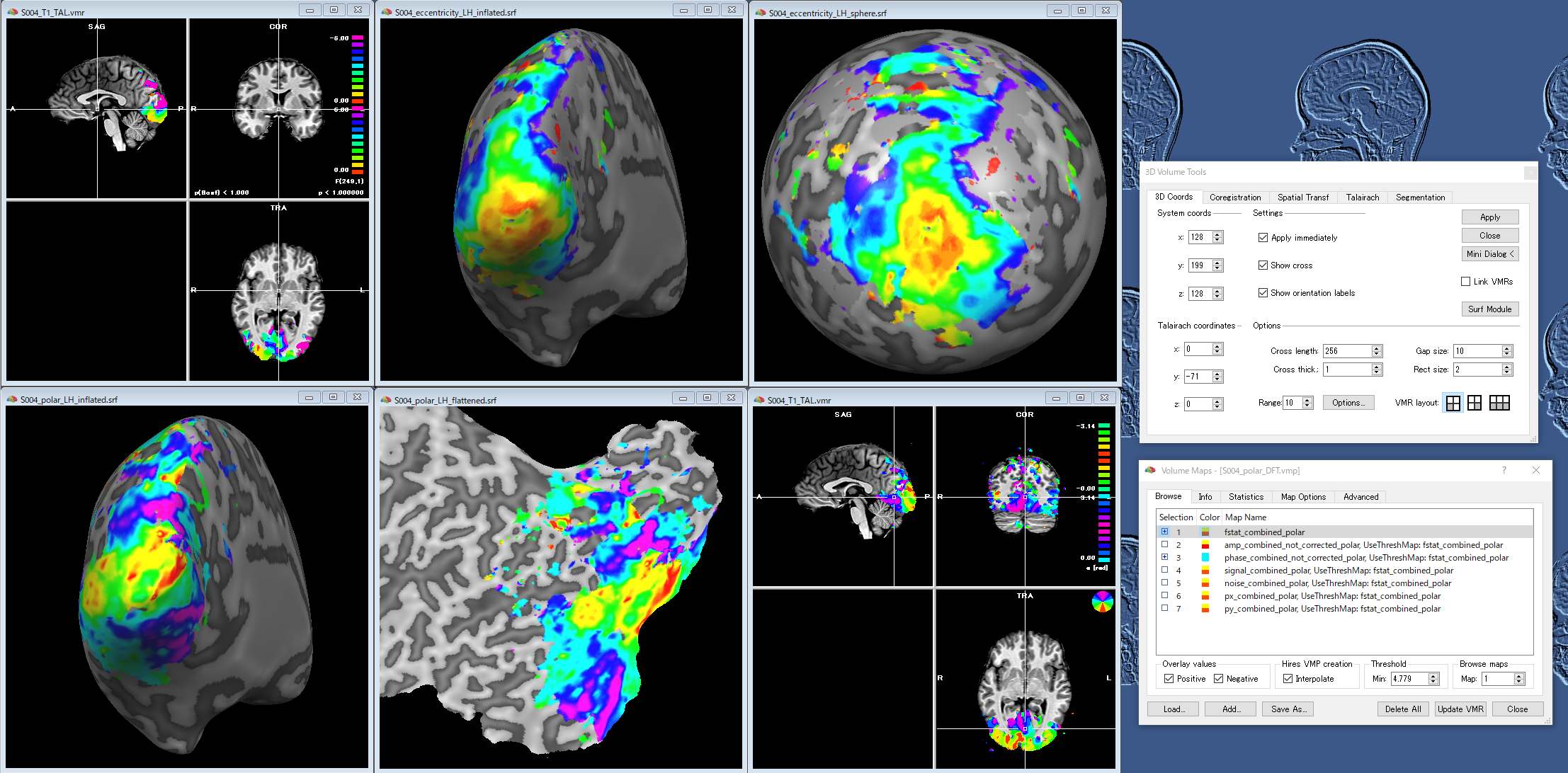 00_Retinotopy_analysis.png