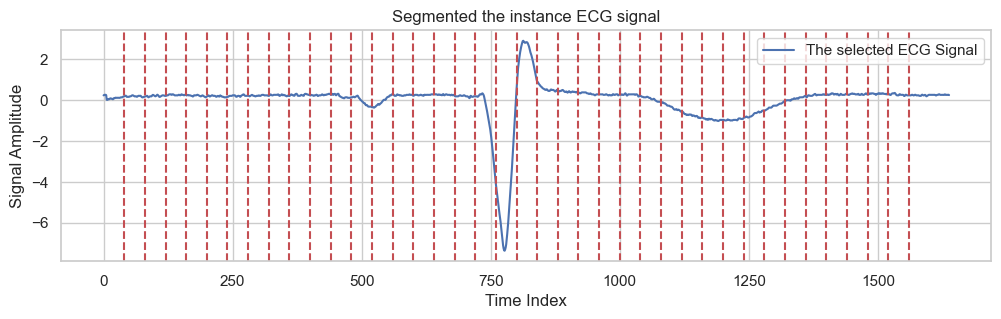 segmented_ecg_signal_sample.png