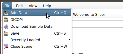 slicer_load_scene.png