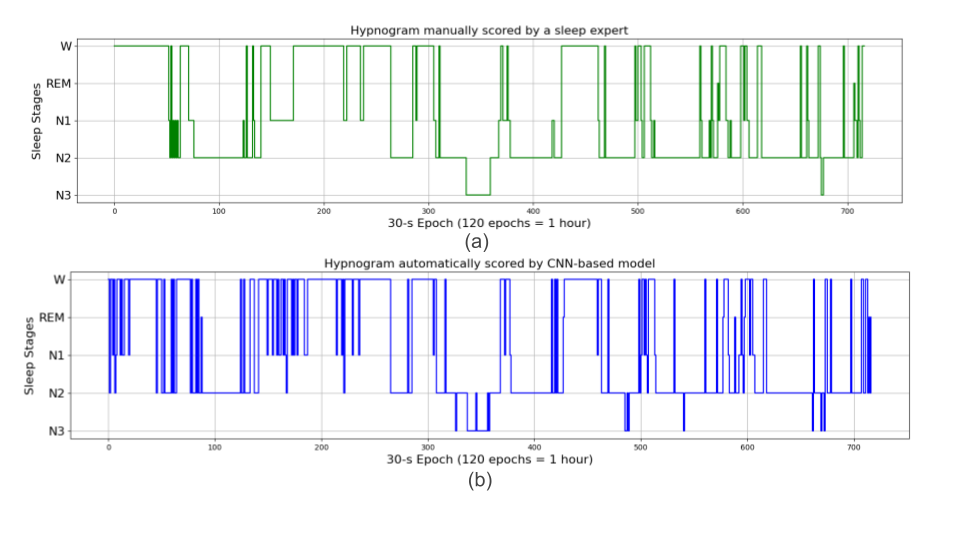 hypnograms.png