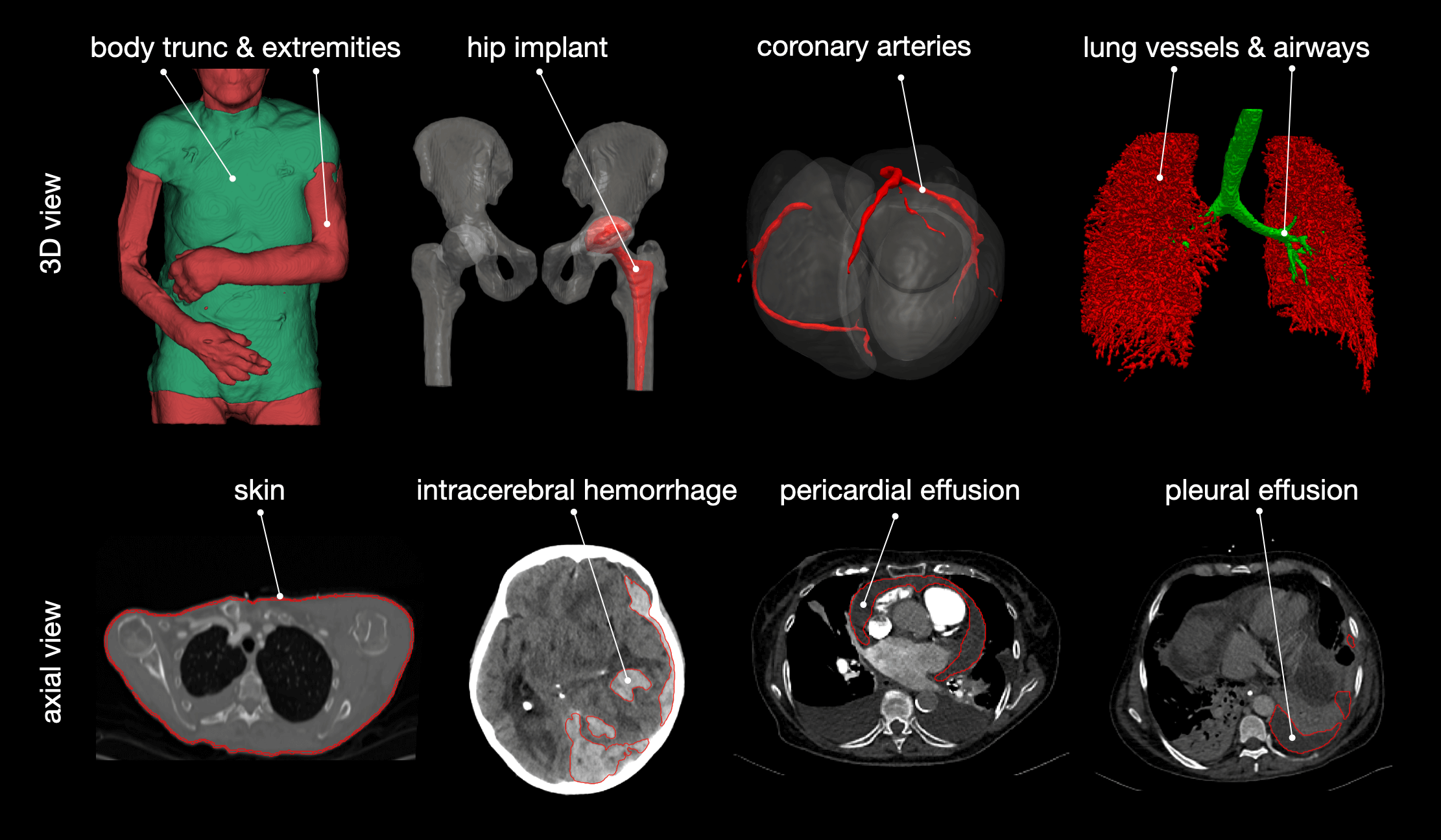 overview_subclasses_2.png